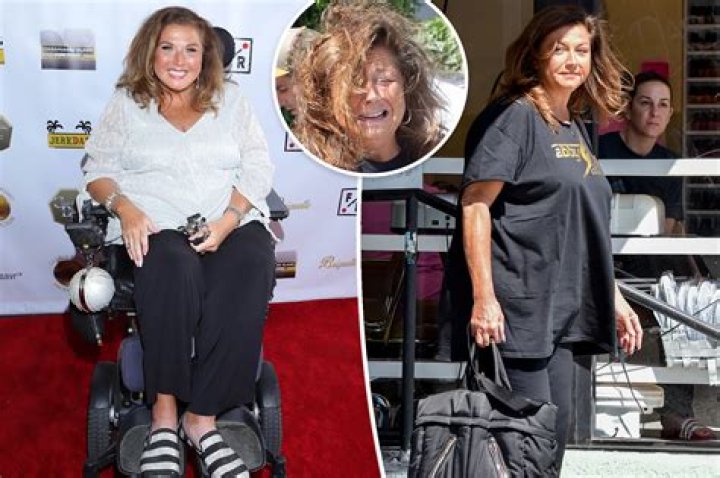 Abby Lee Miller Shows Off Scars, Removes Wig During Cancer Pics
