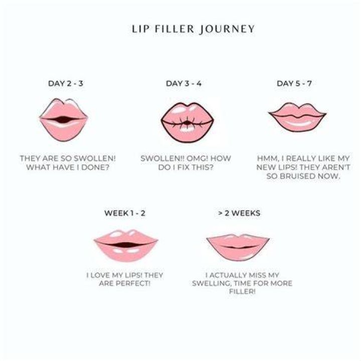 Alanna Panday's Lip Filler Journey Explored