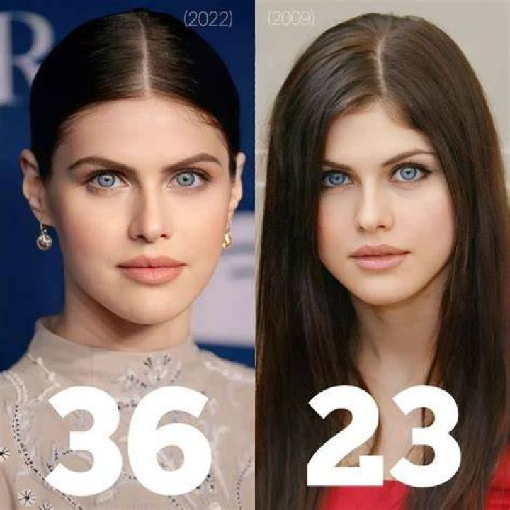 Alexandra Daddario plastic surgery (23) Celebrity plastic surgery online