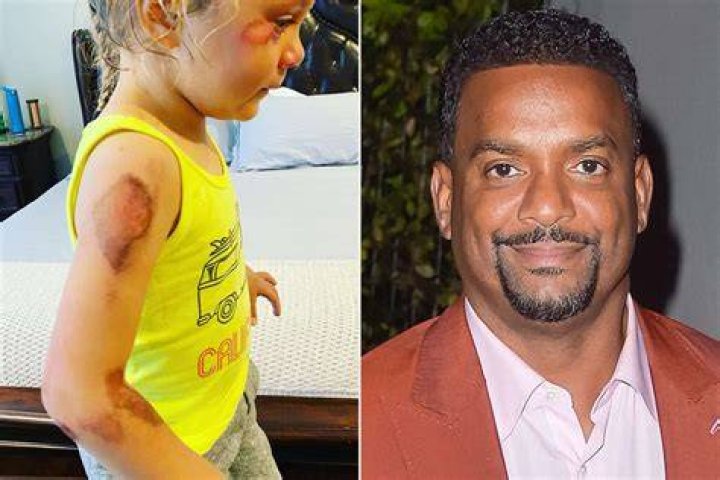 Alfonso Ribeiro Says Daughter, 4, Faces Long Recovery After Doctor