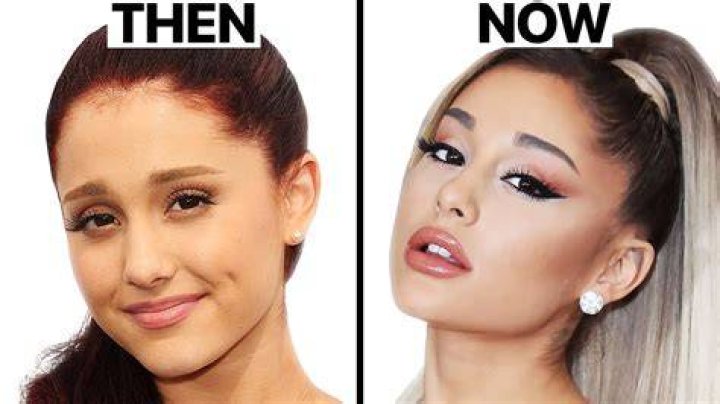 Ariana Grande what plastic surgery did she do?