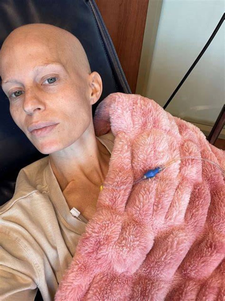 At 33, mom spotted breast cancer diagnosis thanks to Instagram