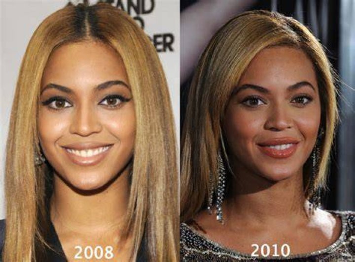 Beyonce Plastic Surgery Boobs (Boob job), Nose Job and Bleach Skin