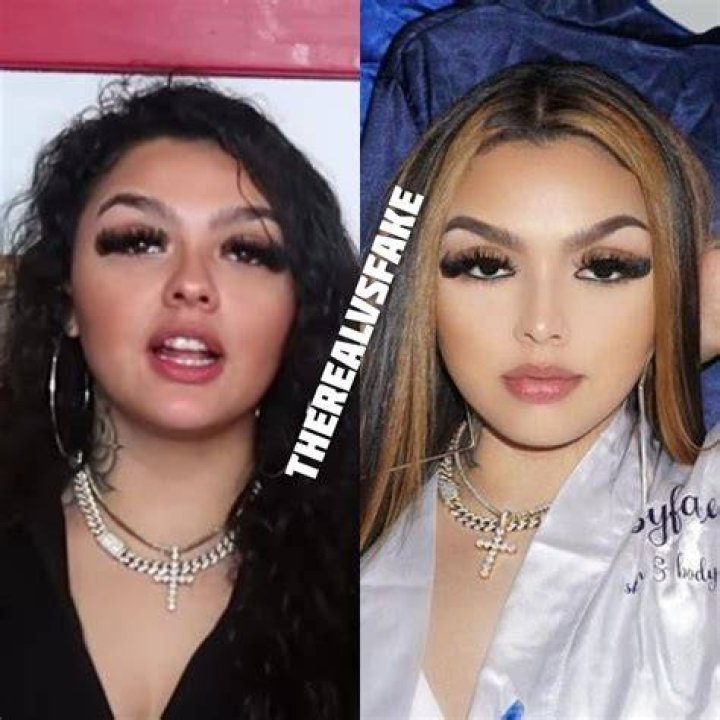 Blueface Babymama Jaidyn Alexis Reality vs Instagram Botox fillers