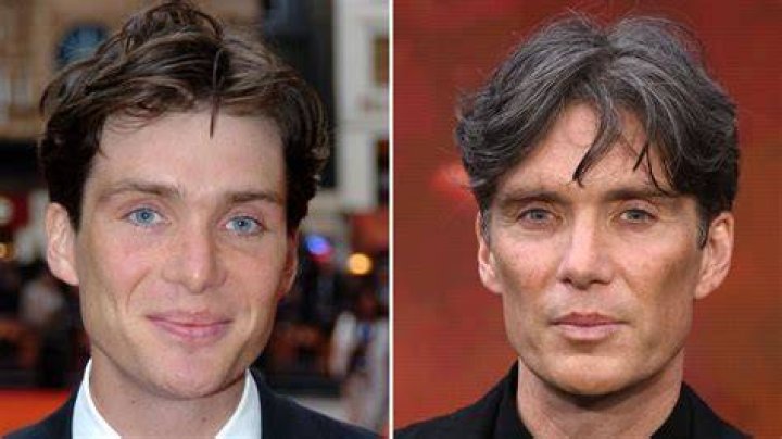 Cillian Murphy Plastic Surgery Fans Suspect Botox Before After