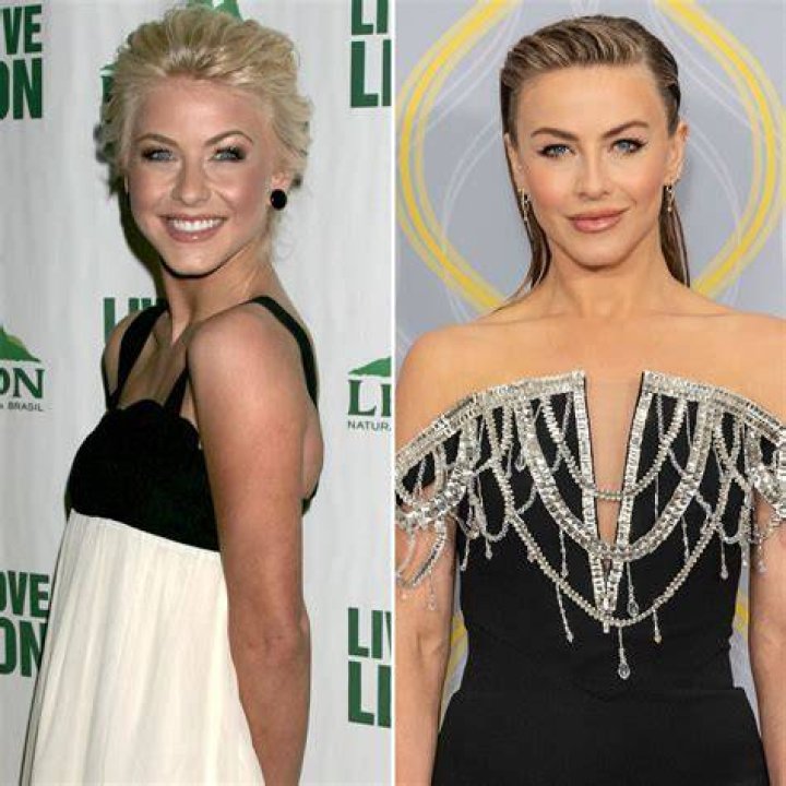 Did Julianne Hough Get Plastic Surgery? Before and After Photos