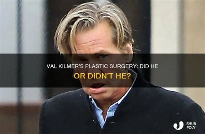 Did Val Kilmer Have Plastic Surgery?