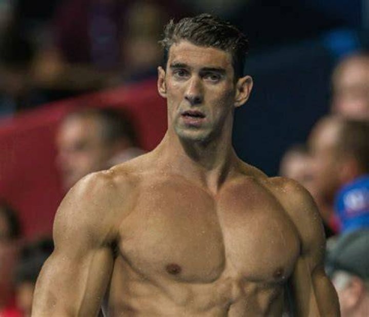 Does Michael Phelps have Marfan syndrome?