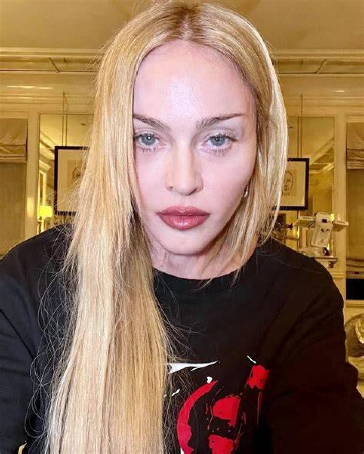 Health Update Madonna Shares First Pictures Since Hospital