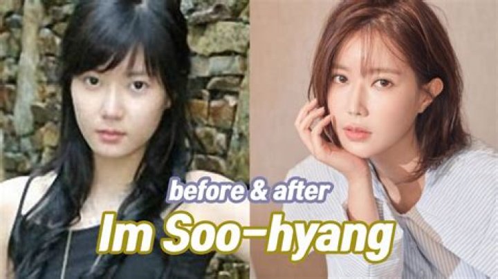 Im Soohyang Before Plastic Surgery Has the Woori the Virgin Star