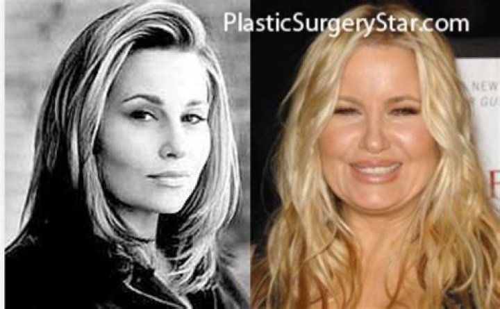 Jennifer Coolidge Plastic Surgery Before and After Photos 2023