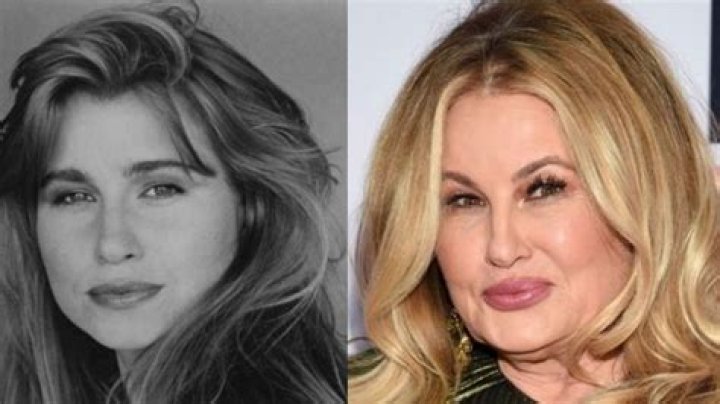 Jennifer Coolidge Plastic Surgery Examine the Before and After