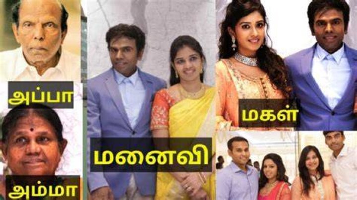 Legend Saravanan is the real Legend in Plastic Surgery Dude literally