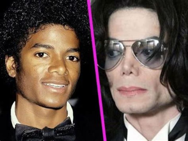 Michael Jackson de la chirurgie esthétique tous les deux mois