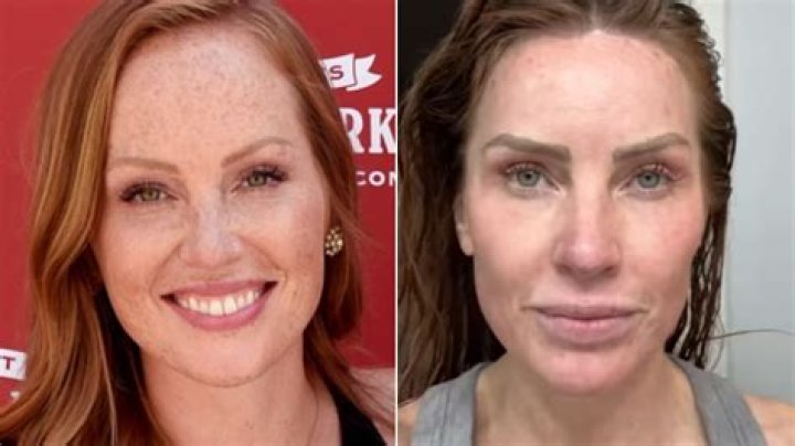Mina Starsiak Hawk Plastic Surgery Photos and Cosmetic Procedures