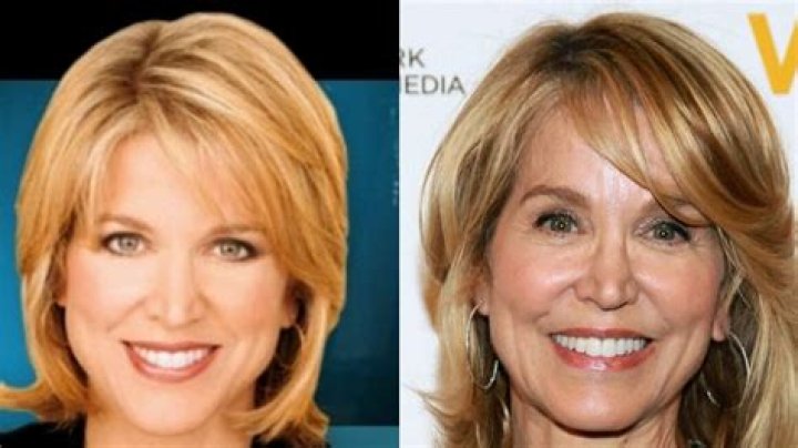 Paula Zahn and her plastic surgery rumors true?