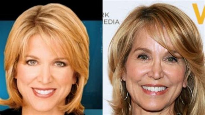 Paula Zahn Plastic Surgery
