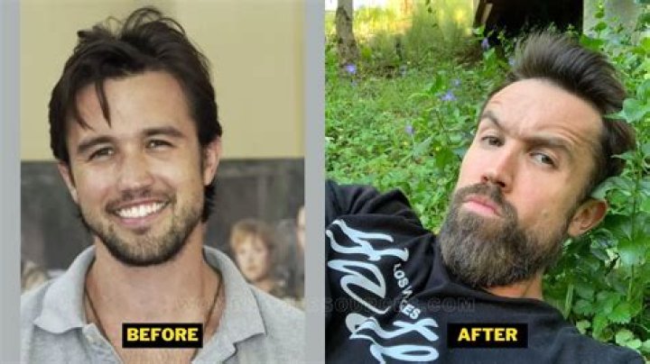 Rob McElhenney Plastic Surgery. Weight Loss And Health Update.