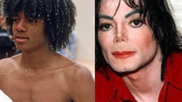 The Michael Jackson Before and After Plastic Surgery