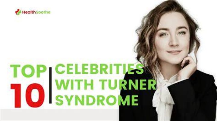 Top 10 Celebrities With Turner Syndrome You Could Never Think Of