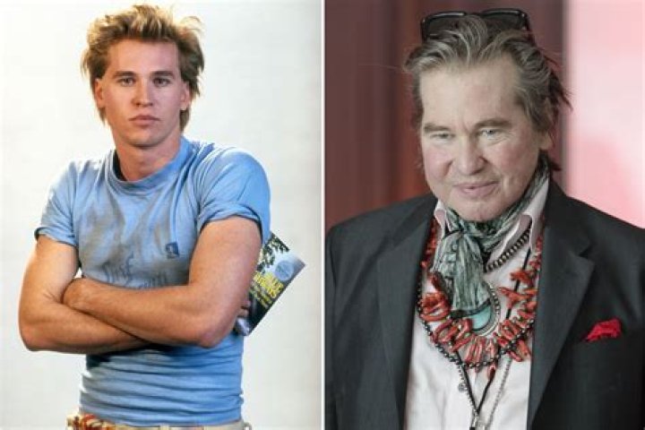 Val Kilmer Before After