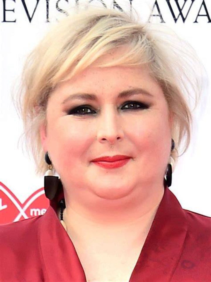 What Happened To Siobhan McSweeney Teeth? Did He Suffer From A Broken