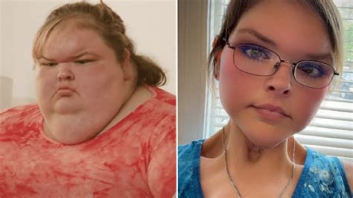 What Happened To Tammy Slaton Forehead In 1000lb Sisters? Trendzified