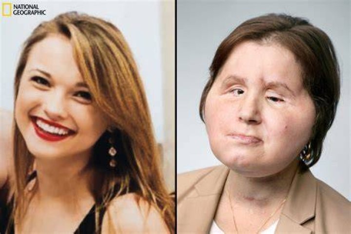 Who is Katie Stubblefield What did she look like before face