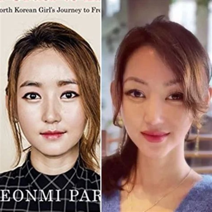 Yeonmi Park Surgery Is It For Real? Genius Updates